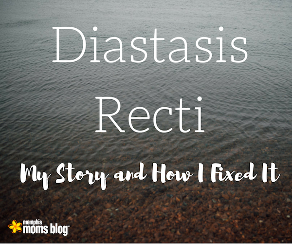 Stuck in the Middle: Diastasis Recti and How I Fixed It